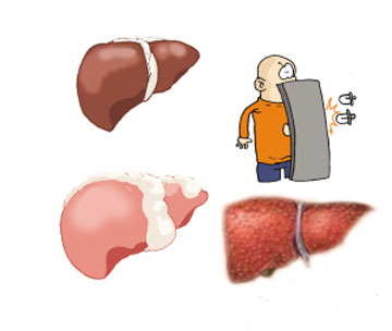 体检验出这4种肝病本来根本不必治纯属自身吓自身(图1)