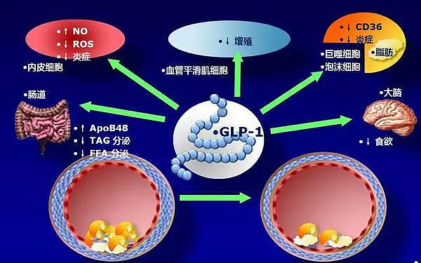 星空体育全站app西安交大二附院展开首例孕珠期甲状旁腺腺瘤射频融化调治(图1)