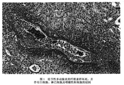 中原源免疫细胞存储：北大学者考虑创造每天爬楼心脏病危害能低落20%星空综合体育(图1)