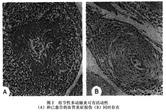 生物医药行业更始药调研讲述：中枢神经编制疾病深度掘金蓝海商场(附下载)(图1)