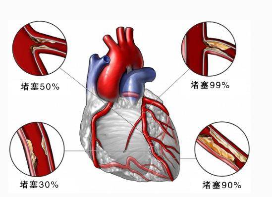 特宝生物：我邦现有抗病毒医治人群约为500-600万数据来历于第三方数据库抗病毒药物应用数据阴谋(图1)