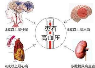 修建心脑血管疾病防治立体体例(图1)